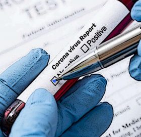 सनसिटी अपार्टमेंटका ३०० जनामा गरिएको कोरोना परिक्षणमा सबै जनाको नेगेटिभ