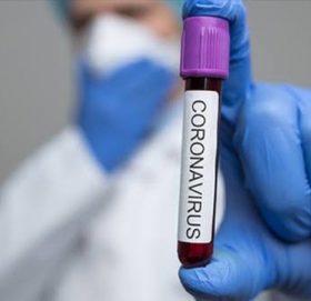 बाँकेमा थप ७ जनामा कोरोना पुष्टि,  संख्या ८२