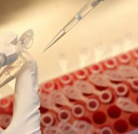 रुसले बनाएको कोरोना खोपको परिणाम सकारात्मक