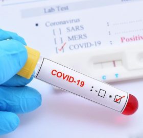 विश्वभर कोरोना संक्रमणबाट २७ लाख ९५ हजार ५ सय नाघ्यो