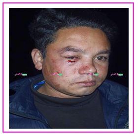 सामान लिएर रामेछाप आइरहेका ट्रक चालक सिन्धुलीमा बिना कारण निर्घत कुटिए